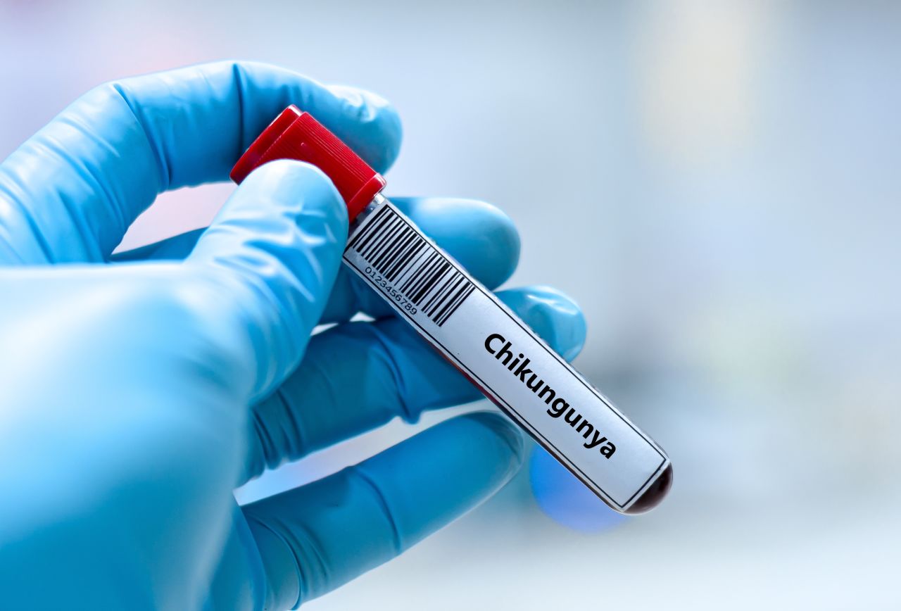 Blood sample tube for chikungunya virus test analysis.